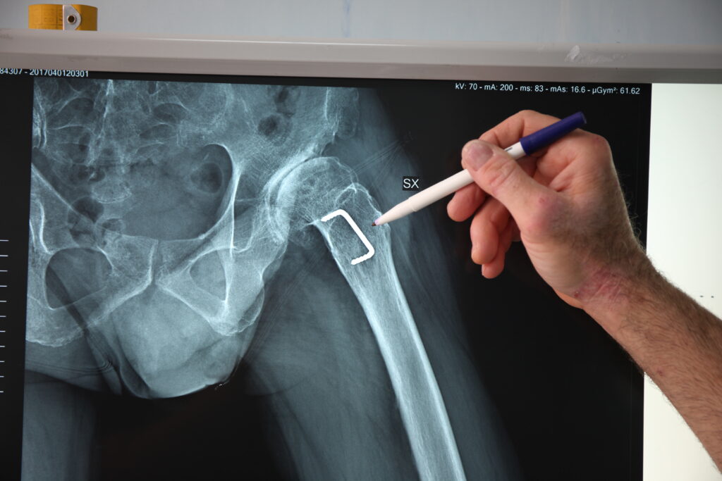 ripresa procedura livesurgery