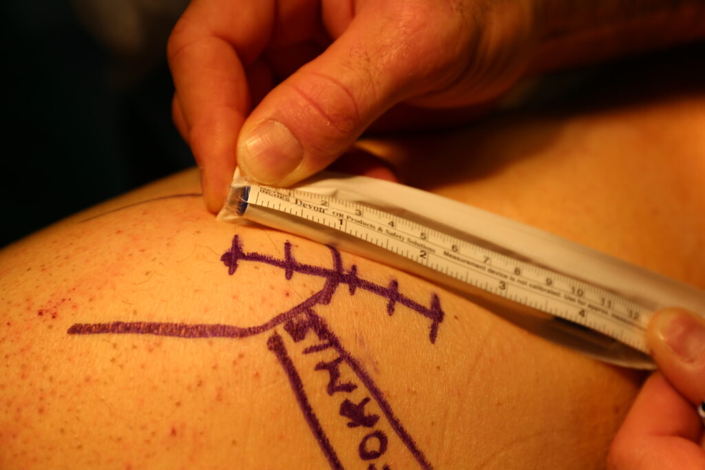 ripresa procedura livesurgery